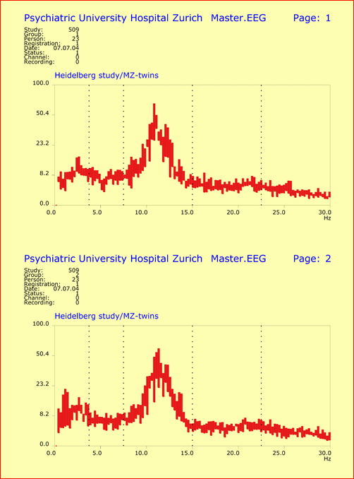 EEG Spectral Patterns of Monozygotic Twins