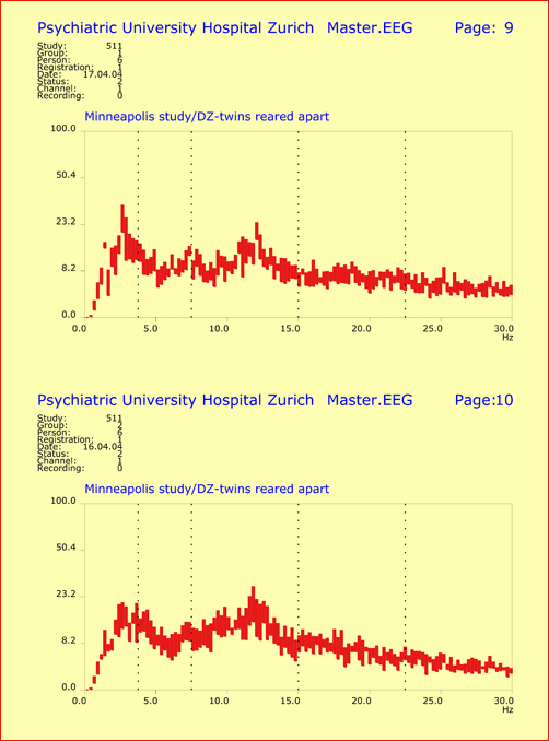EEG Spectral Patterns of Dizygotic Twins